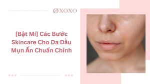 các bước skincare cho da dầu mụn ẩn